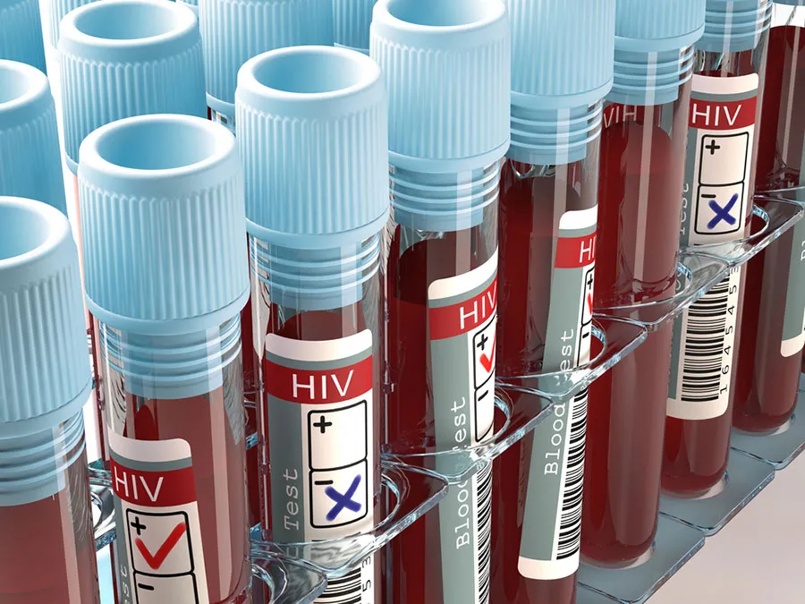 fifth-person-has-been-cured-from-hiv-with-stem-cell-cancer-treatment