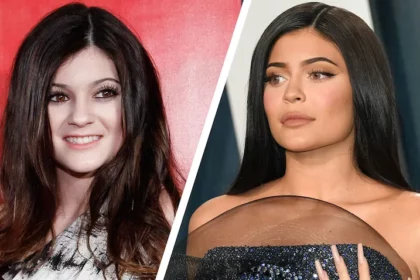 kylie-jenner-addresses-misconception-about-her-plastic-surgery-history