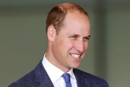 prince-william-could-see-a-full-head-of-hair-with-hair-system-or-smp-says-expert