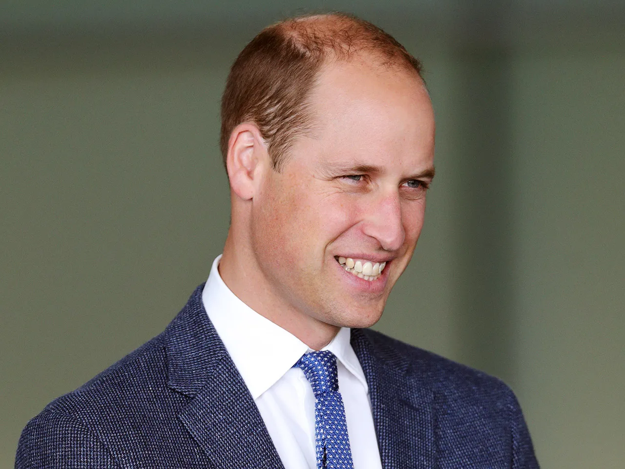 prince-william-could-see-a-full-head-of-hair-with-hair-system-or-smp-says-expert
