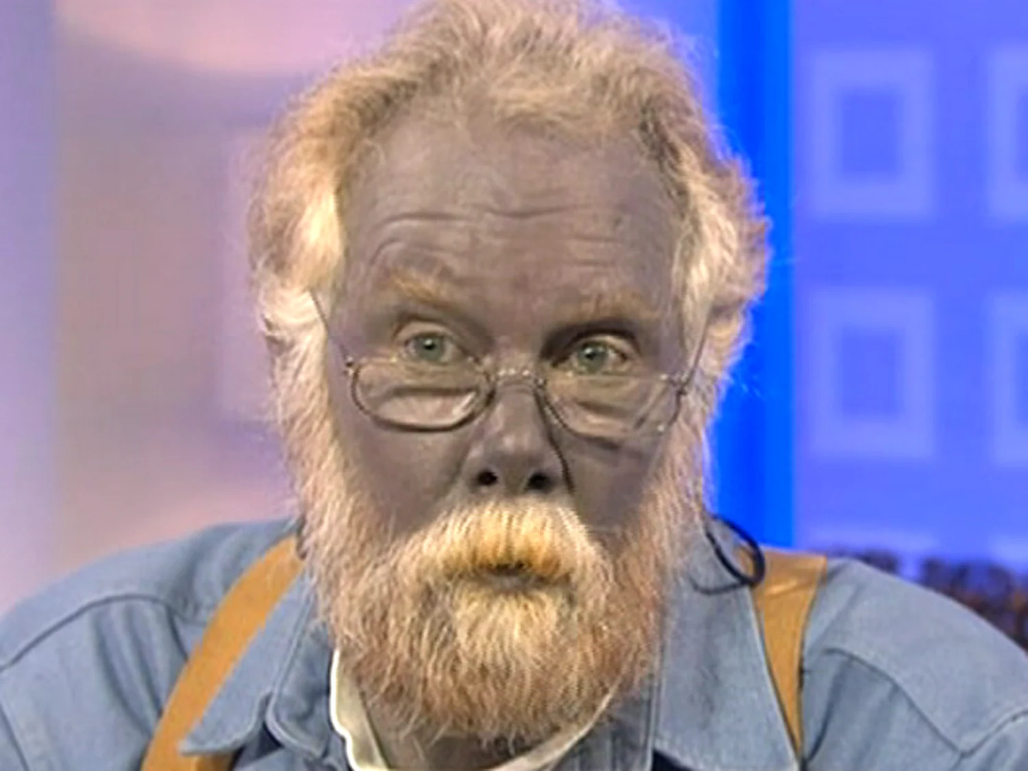 paul-karason-the-man-who-turned-blue-from-colloidal-silver