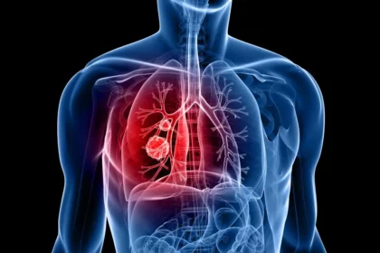 lung-cancer-pills-reduce-risk-of-death-by-half-study