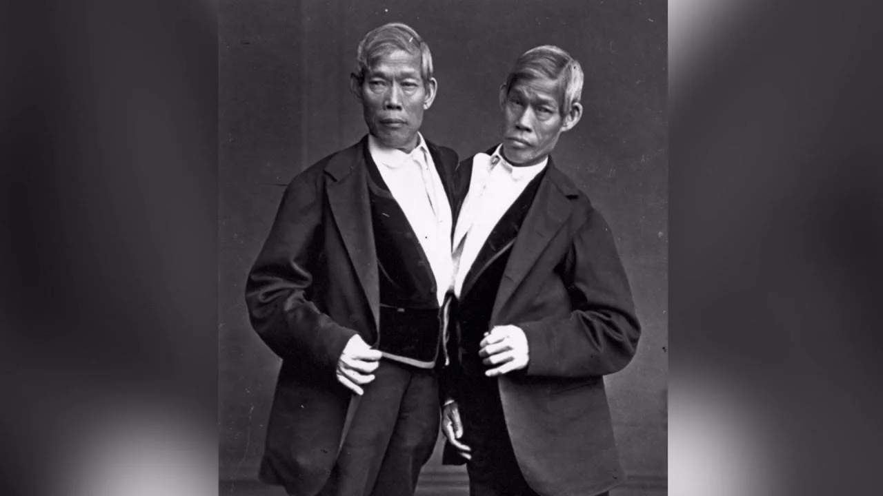 the-tragic-story-of-siamese-twins-chang-and-eng-bunker-guinness-world-records