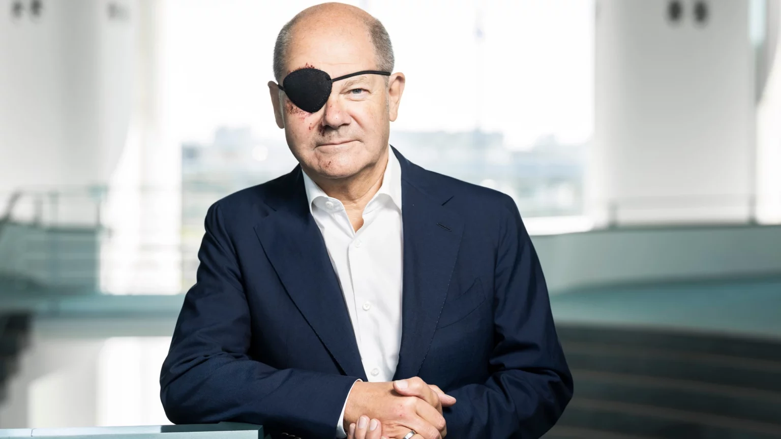 german-chancellor-scholz-tweets-a-pirate-style-picture-of-himself-with-a-black-eye-patch-after-a-jogging-accident