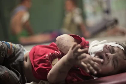 doctors-visiting-hospital-in-gaza-stunned-by-wars-toll-on-palestinian-children-al-arabiya