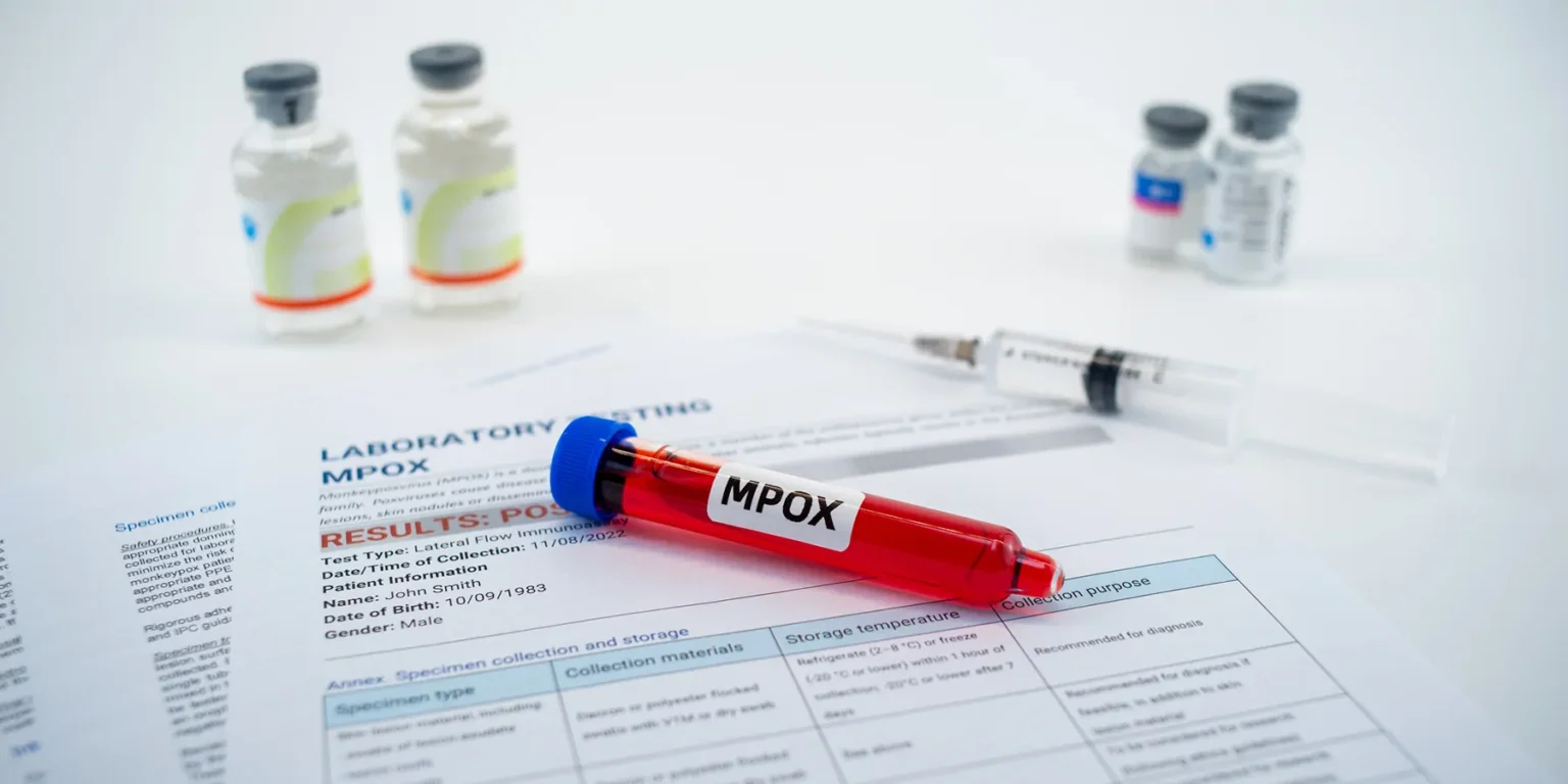 south-africa-reports-second-death-from-mpox-this-week