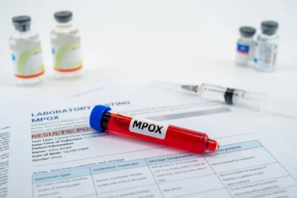 south-africa-reports-second-death-from-mpox-this-week